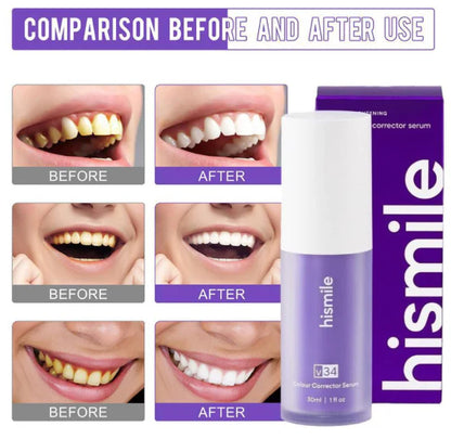 Hismile v34 Purple Tooth Whitener